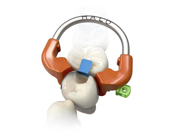 Ultradent™ Halo™ Universal Matrix Rings